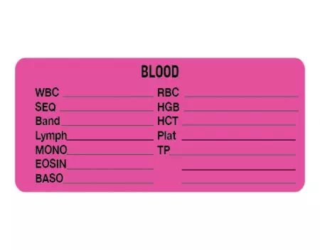 Label, Blood WBC___ SEG___RBC___HGB____