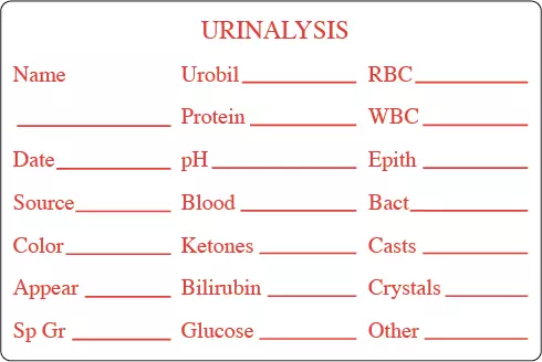 Urinalysis Results - Name____ Urobil____ RBC____