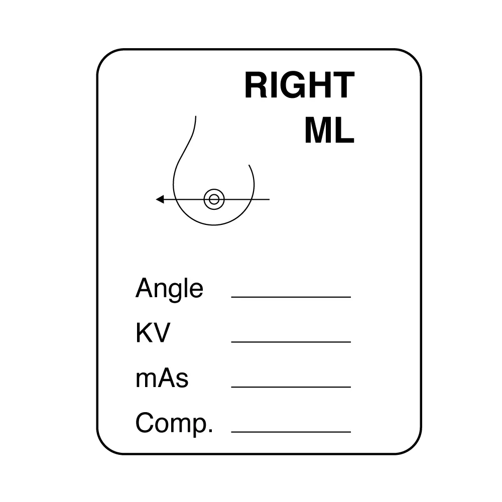 Mammography Labels - Right ML